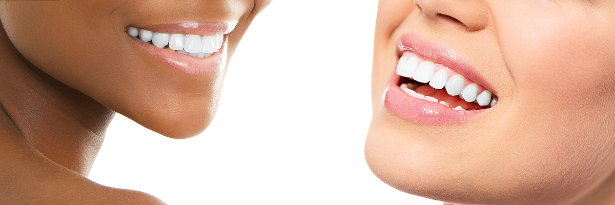 teeth-whitening-header
